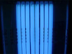 UV exposure for psoriasis