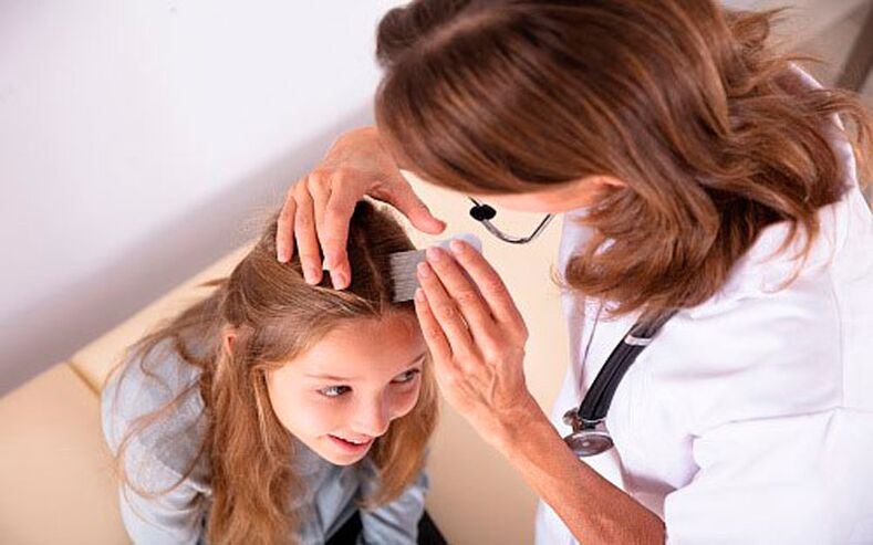 Treatment of scalp psoriasis in children