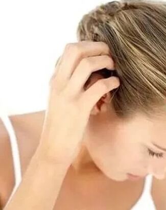 Treatment of psoriasis