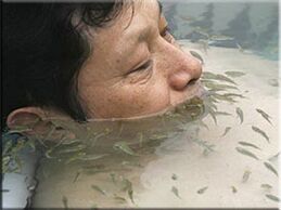 Fish therapy