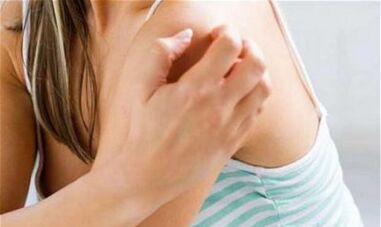 Girl scratching her shoulders